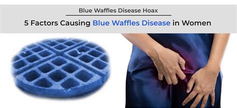 what is blue waffle disease|Blue Waffle Disease: Symptoms, causes, diagnosis, .